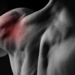 Артрит плечевого сустава симптомы и лечение