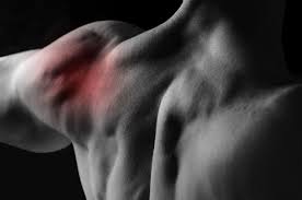 Артрит плечевого сустава, симптомы и лечение