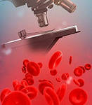 Анализ крови под микроскопом