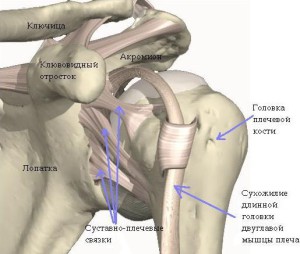 Воспаление плечевого сустава лечение