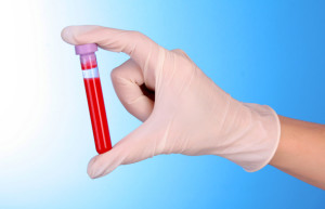 Анализ крови биохимический расшифровка