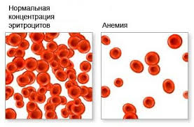 кровяные клетке в норме и при анемии