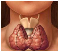 увеличение щитовидной железы