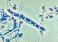 грибок ног под микроскопом